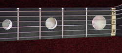 inlays