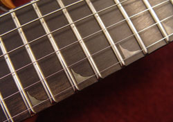 inlays